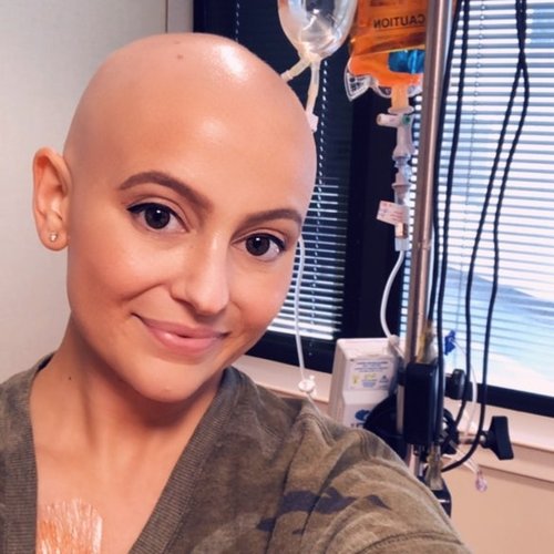 Hairgrowth PostChemotherapy  Young women with Breast Cancer  YouTube