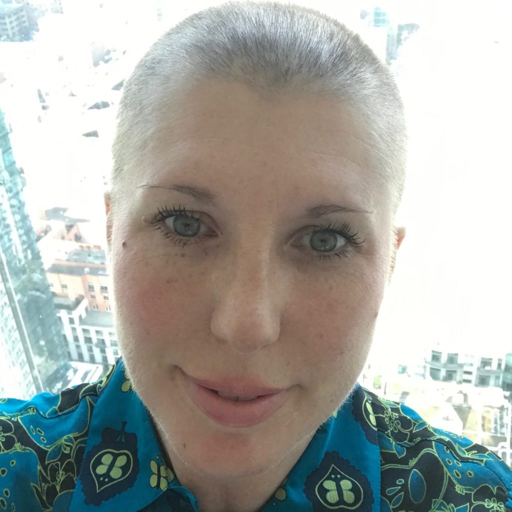 Best Does Chemotherapy Always Make You Lose Your Hair for Short Hair