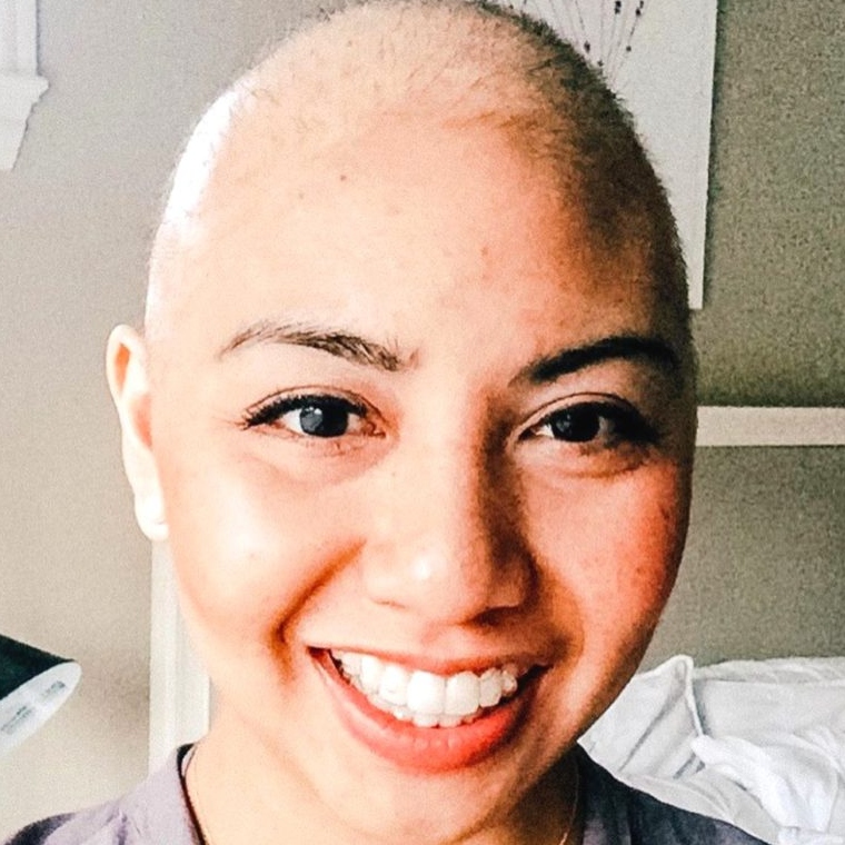 cancer hair loss