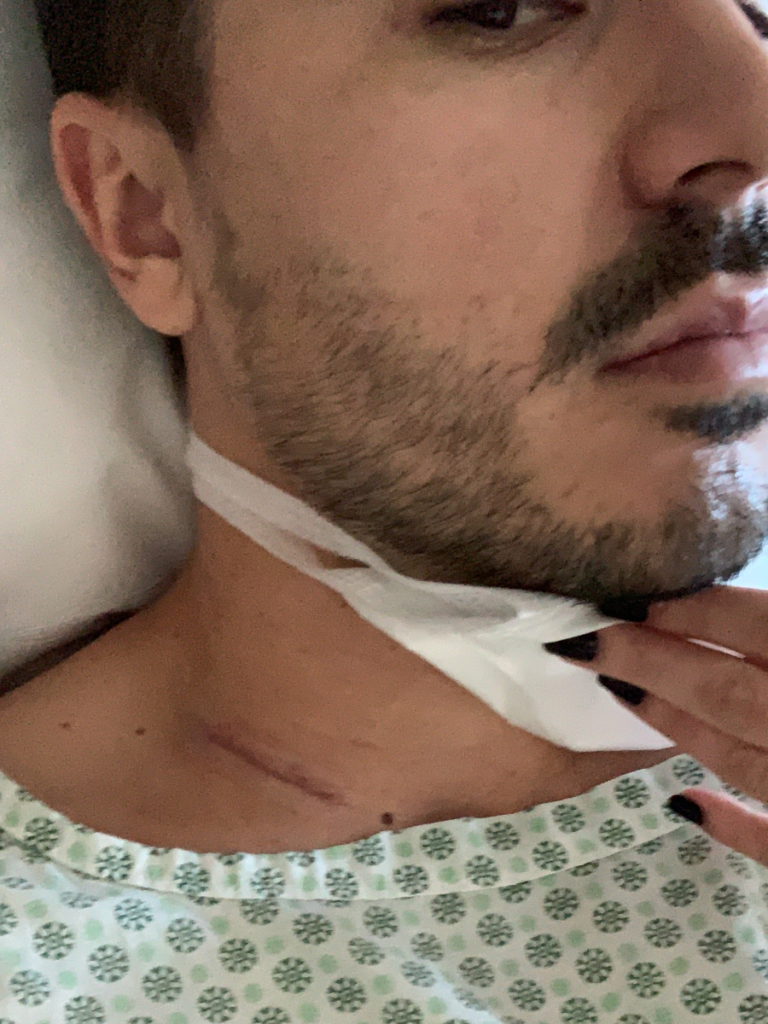 Emmanuel S. scar at the base of neck