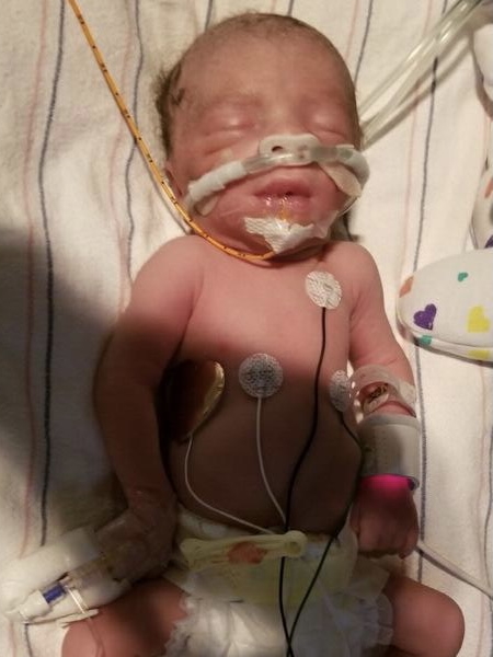 Renata R. Michael in NICU