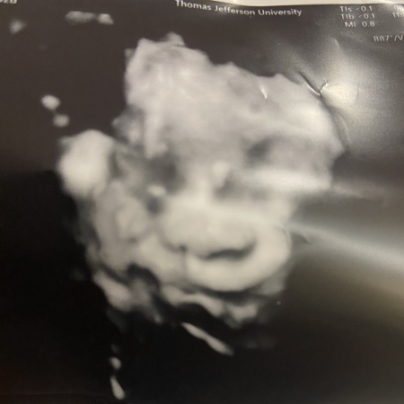 Renata R. baby ultrasound
