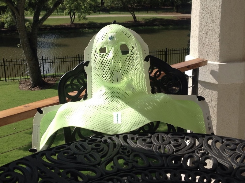 Robyn S. Aug 2015 radiation therapy head mold