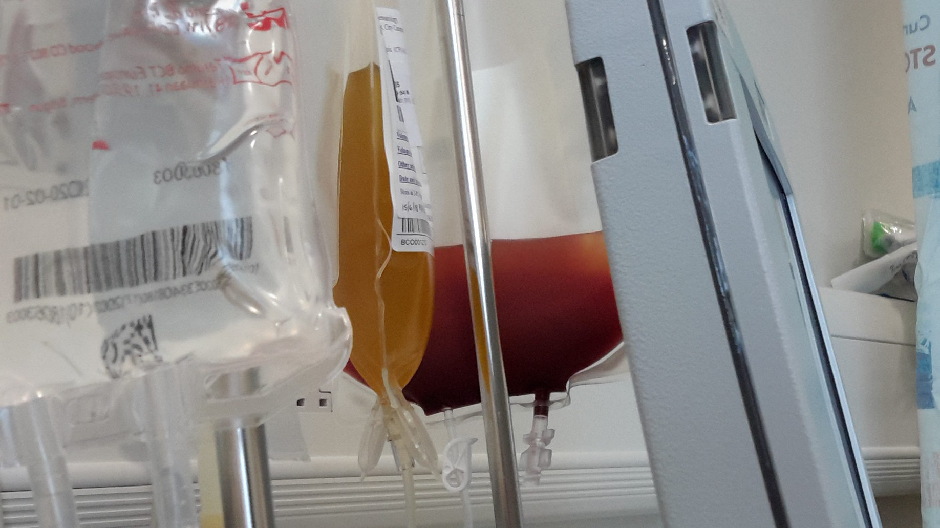 stem cell transplant