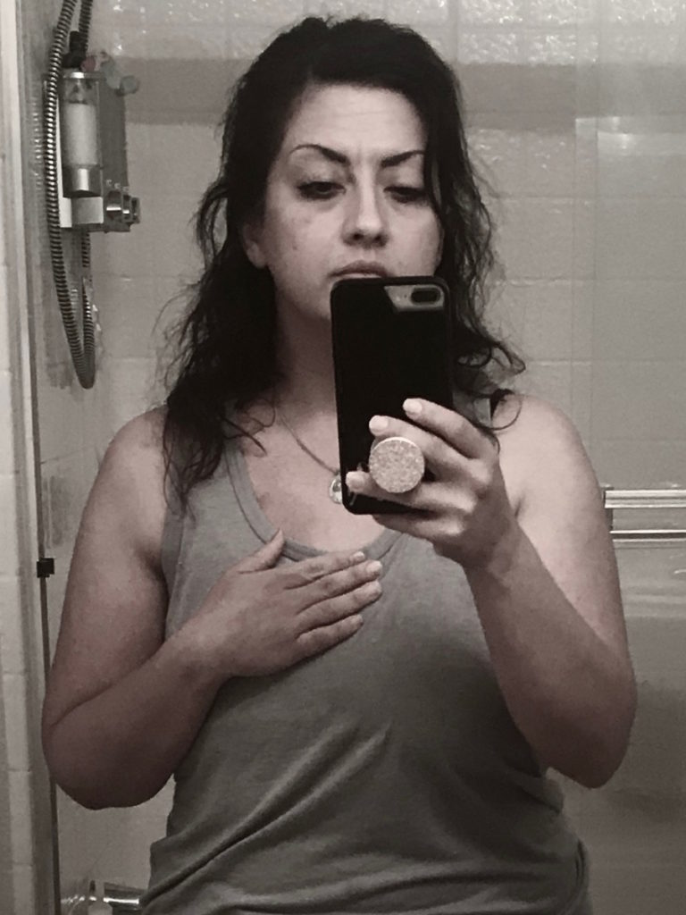 Renee F. breast self-exam