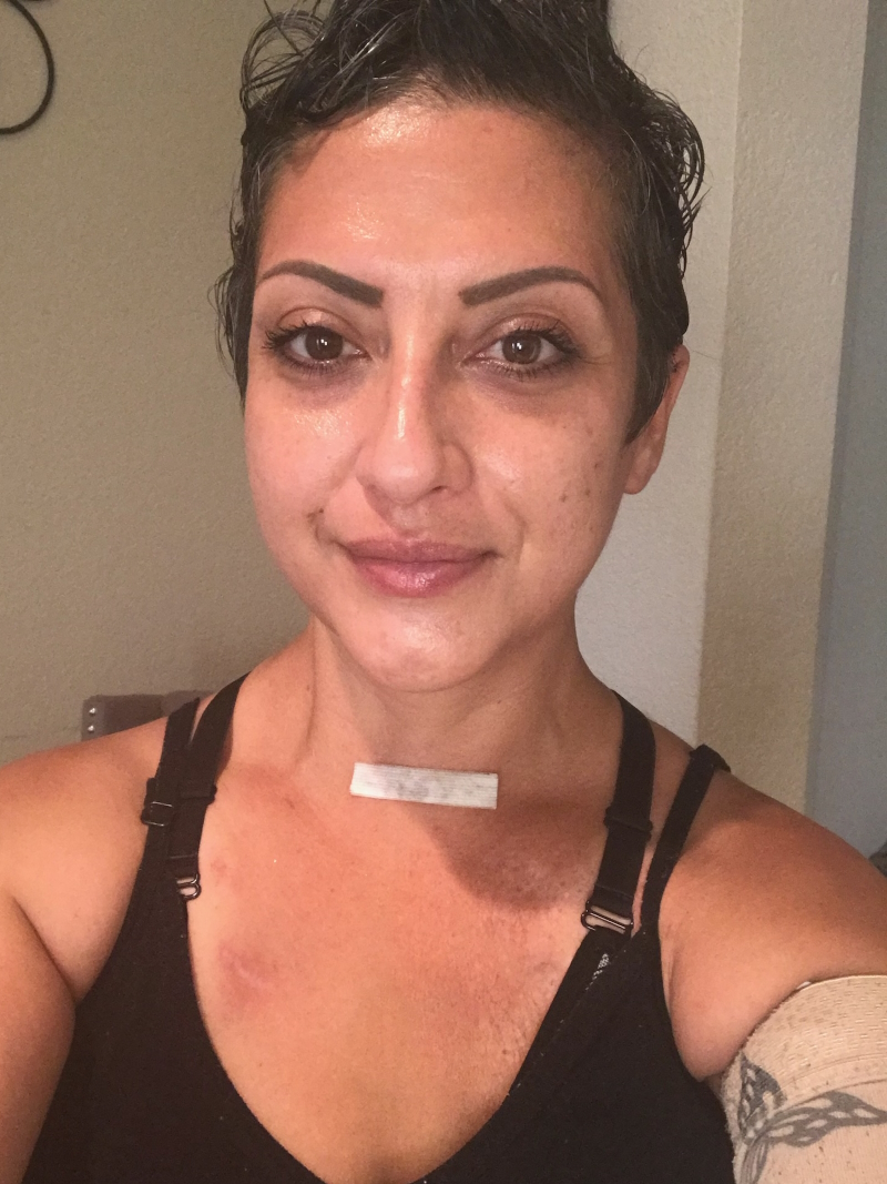 Renee F. in the hospital