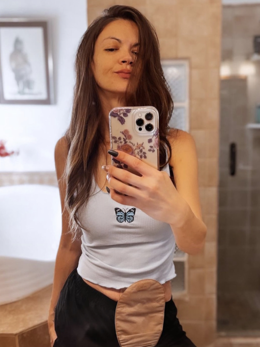 Amy H. ostomy bag