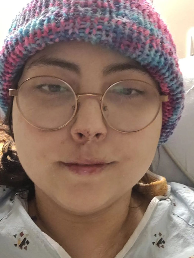 Tatijane W. post brain surgery