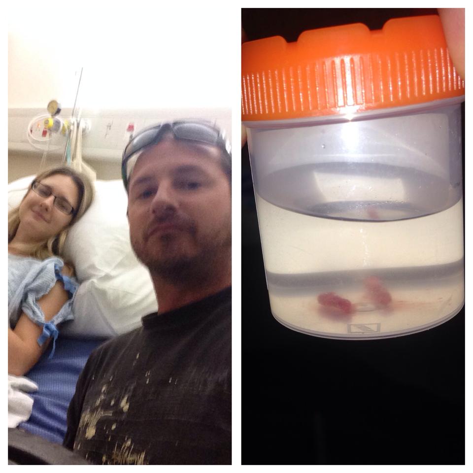 Nicky had a bone marrow extraction to accurately diagnosis her cancer