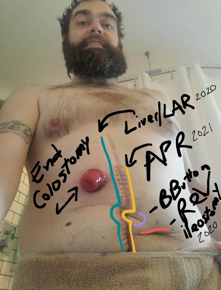 Jason encourages cancer patients to take it day by day